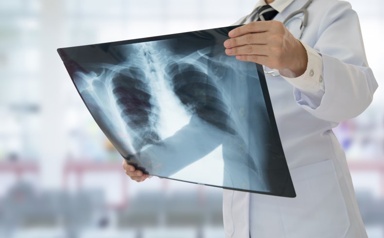 doctor, chest, xray, stock
