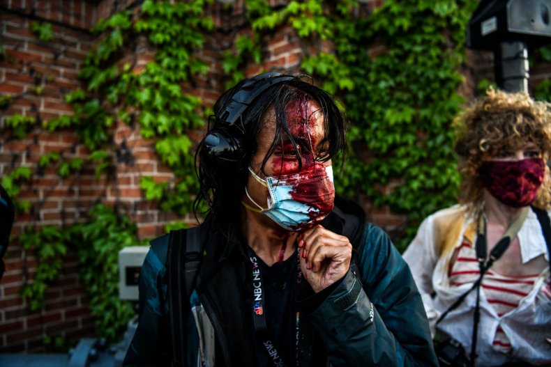 NBC Journalist Bloodied at Protest