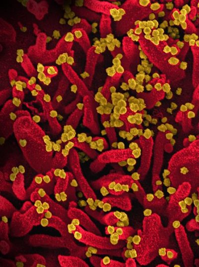 covid19, coronavirus, sars-cov-2, covid19, coronavirus, sars-cov-2,