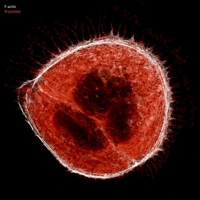 covid19, coronavirus, sars-cov-2, covid19, coronavirus, sars-cov-2,