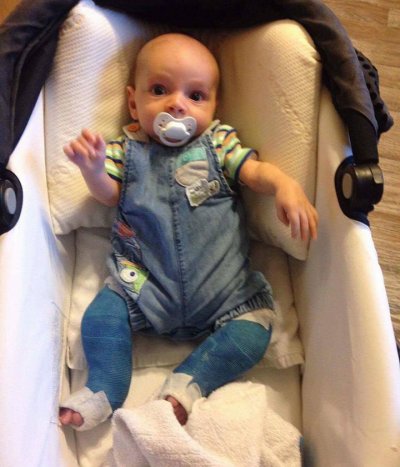 Fundraising, walking, prosthetics, family Fundraising, walking, prosthetics, family