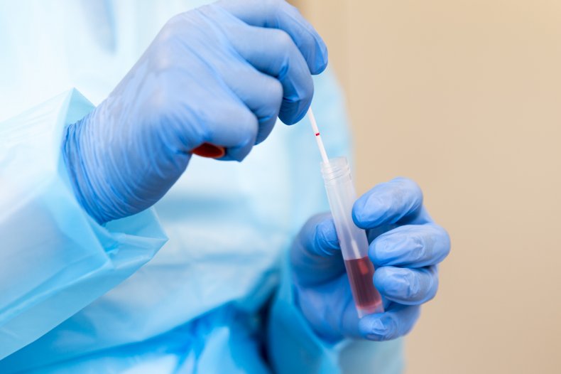 Coronavirus test