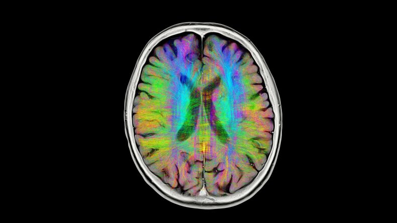 Newsweek AMPLIFY Your Brain is Shrinking
