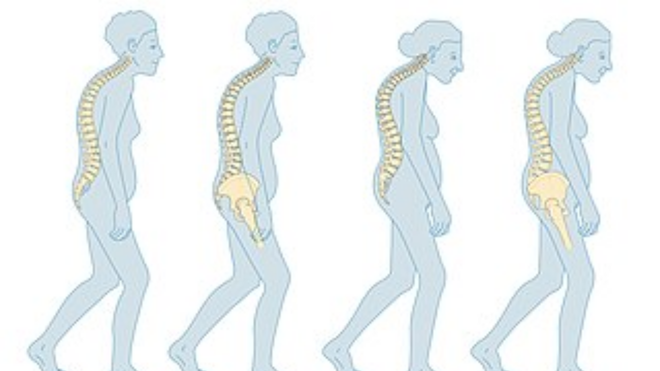 Newsweek AMPLIFY-  Reversing Osteoporosis