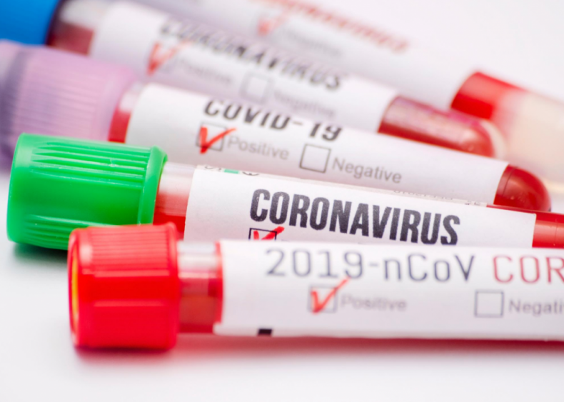 Children are less likely to be tested for COVID-19 Children are less likely to be tested for COVID-19