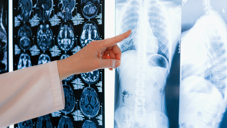 Newsweek AMPLIFY - COVID-19 Lung Damage