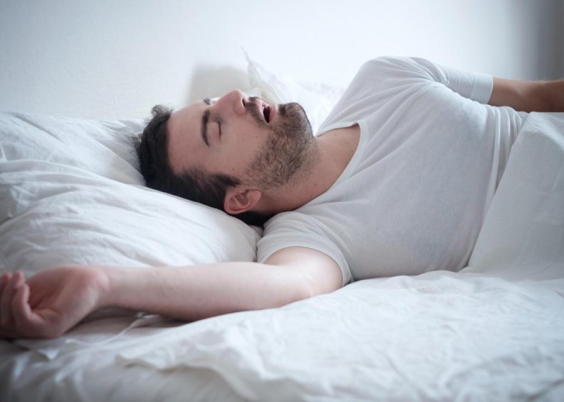 Obstructive sleep apnea