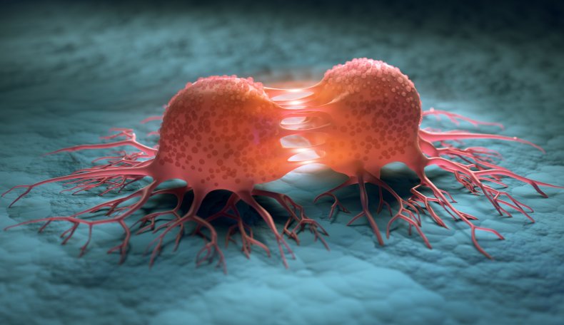 tumor
