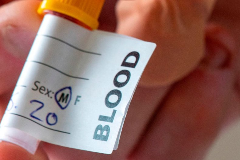 A blood test sample for COVID antibodies