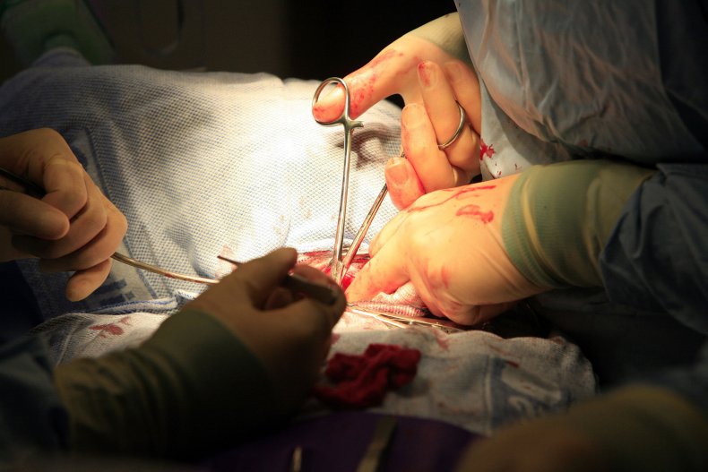 Organ donation
