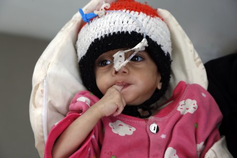 yemen, war, children, malnutrition, famine