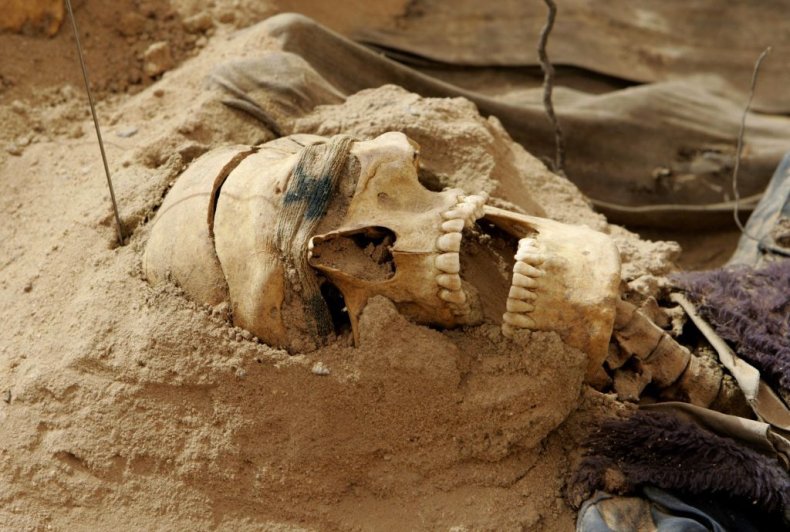 human skull