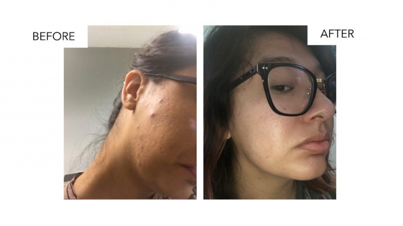 kalumi beautyfood collagen