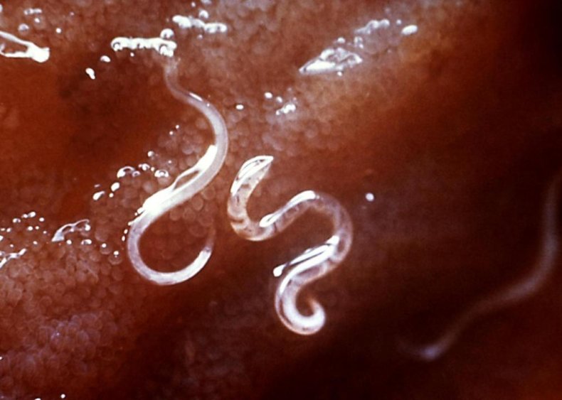 Parasites can't really treat allergies