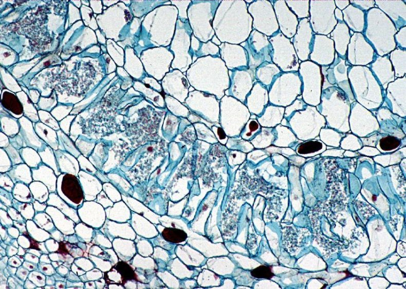 Changing the gut microbiome could help prevent food allergies