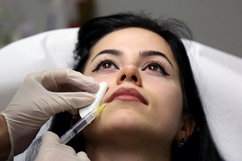 Tiktok Skincare, dermalfillerbeforeandafter Specialists Warn In opposition to TikTok Development to Self-Inject Hyaluronic Acid, dermalfillerbeforeandafter