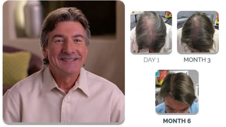 scalpmed claims guaranteed hair growth
