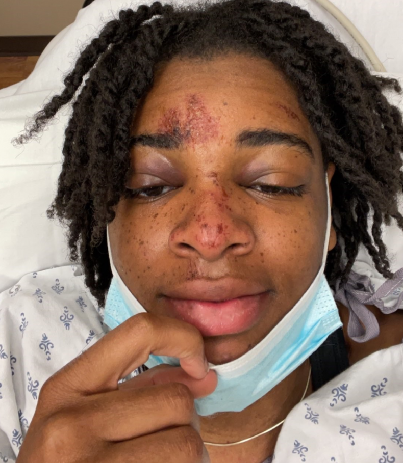 Jazz Evans in hospital