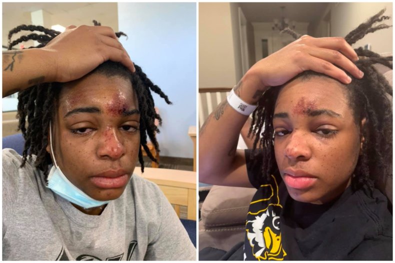 Jazz Evans injuries