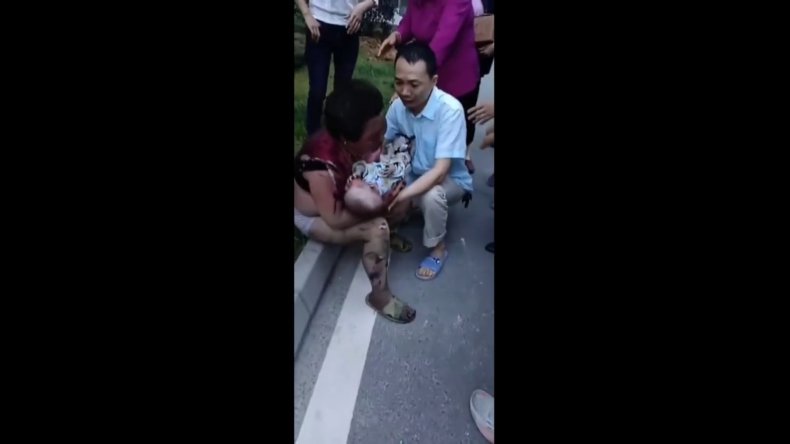 5 Burned As Electric Bike Battery Explodes
