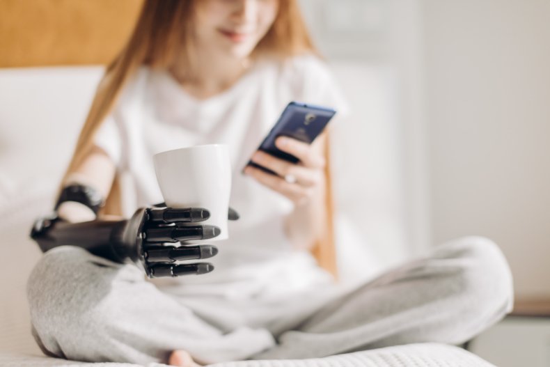 woman prosthetic arm