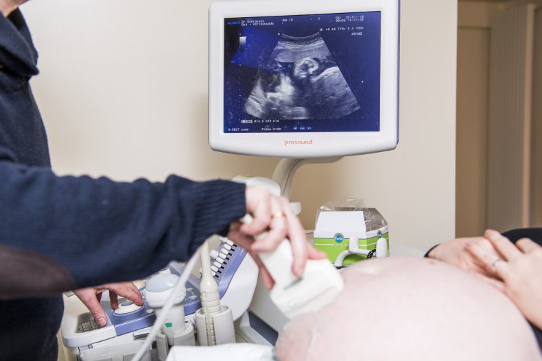Dentists knows patients are pregnant from teeth