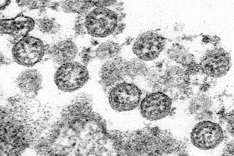 Microscopic Look at Supposed First Covid Case