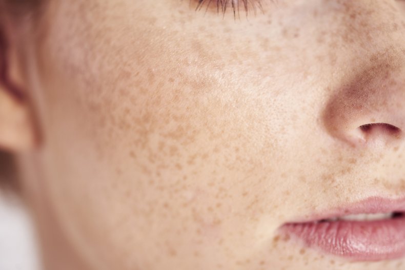 Close up of woman's freckles