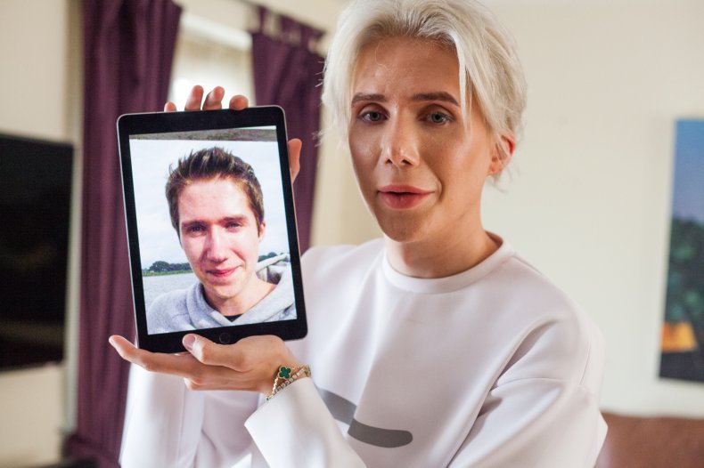 Oli London before surgery