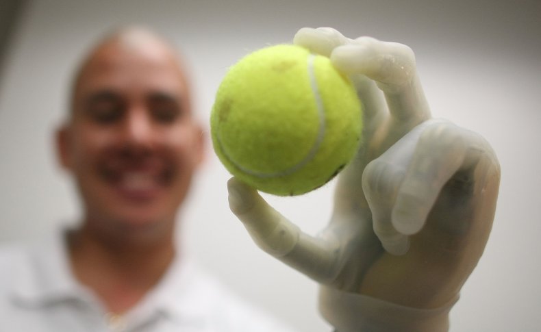 Bionic Hand