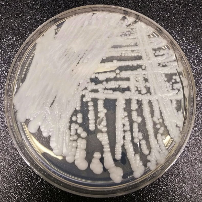 CDC Reports 'Superbug' Outbreaks