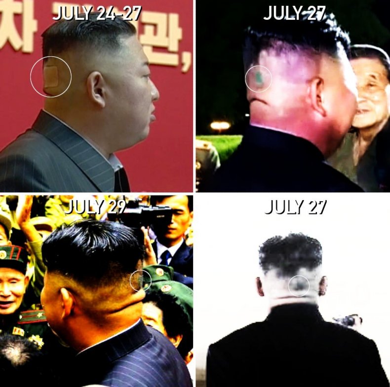 Photos Show Kim's Bandage and Discolored Spot