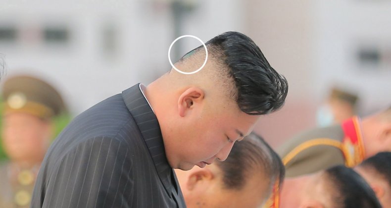 Greenish Spot Photographed on Kim's Head