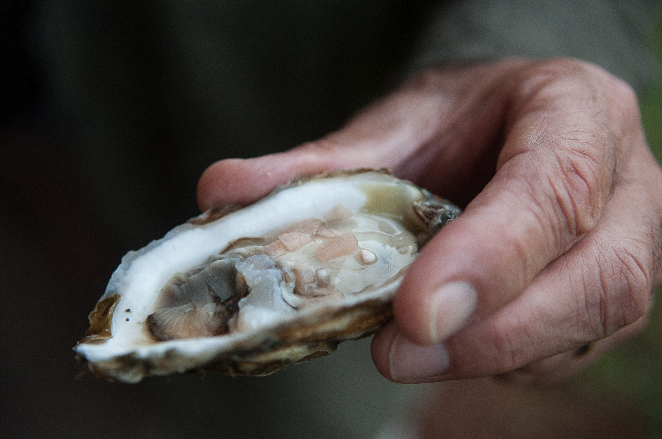 Indiana Man Hospitalized With Flesh Eating Bacteria After Eating Raw Oysters 