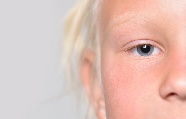 File photo of girl with blue eyes.