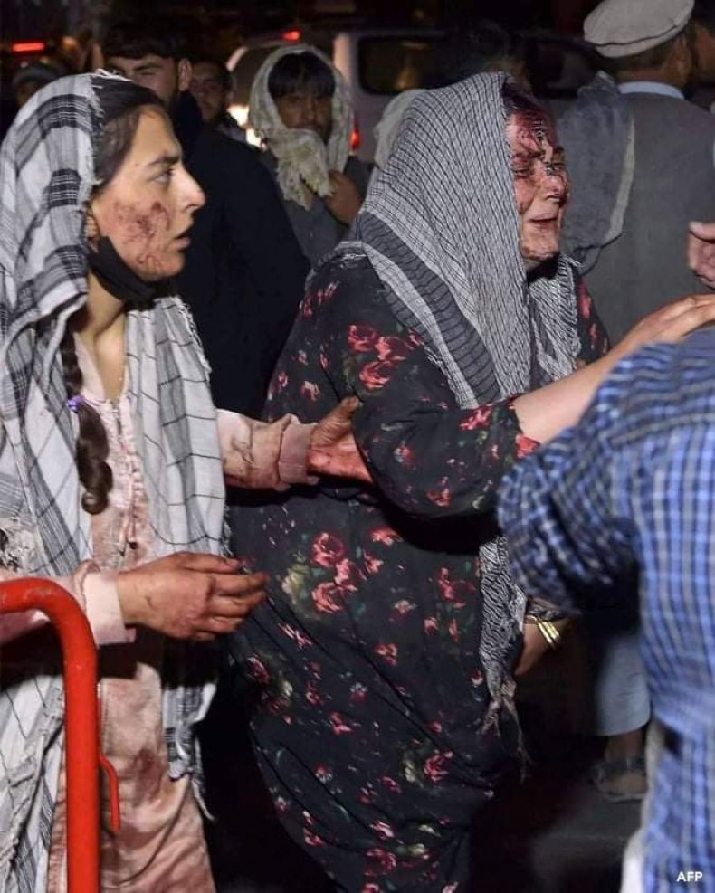 Blast at Kabul airport cause many casualties