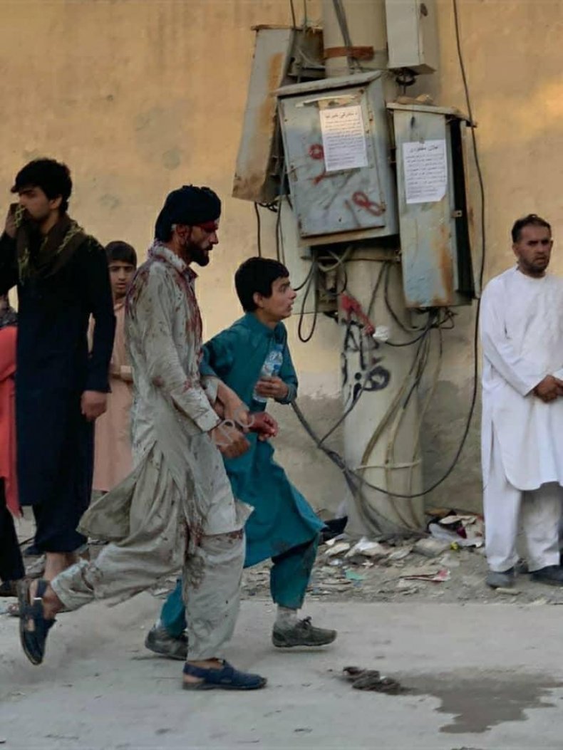 Blast at Kabul airport cause many casualties