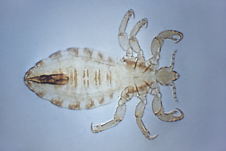 A body louse, carrier of epidemic typhus.