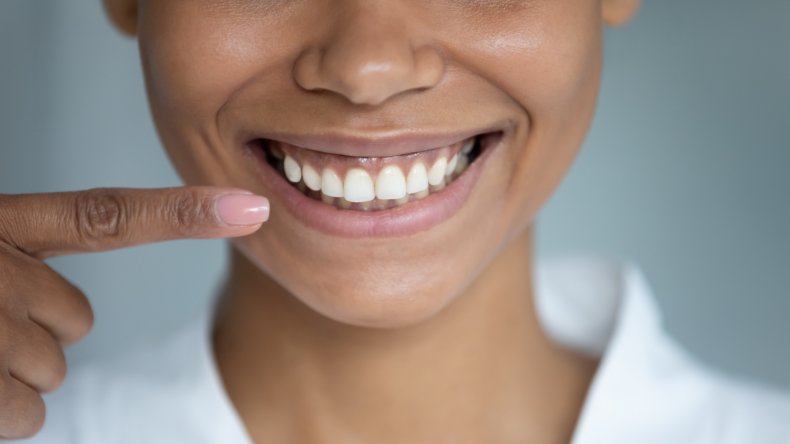 Woman smiling and pointing to teeth