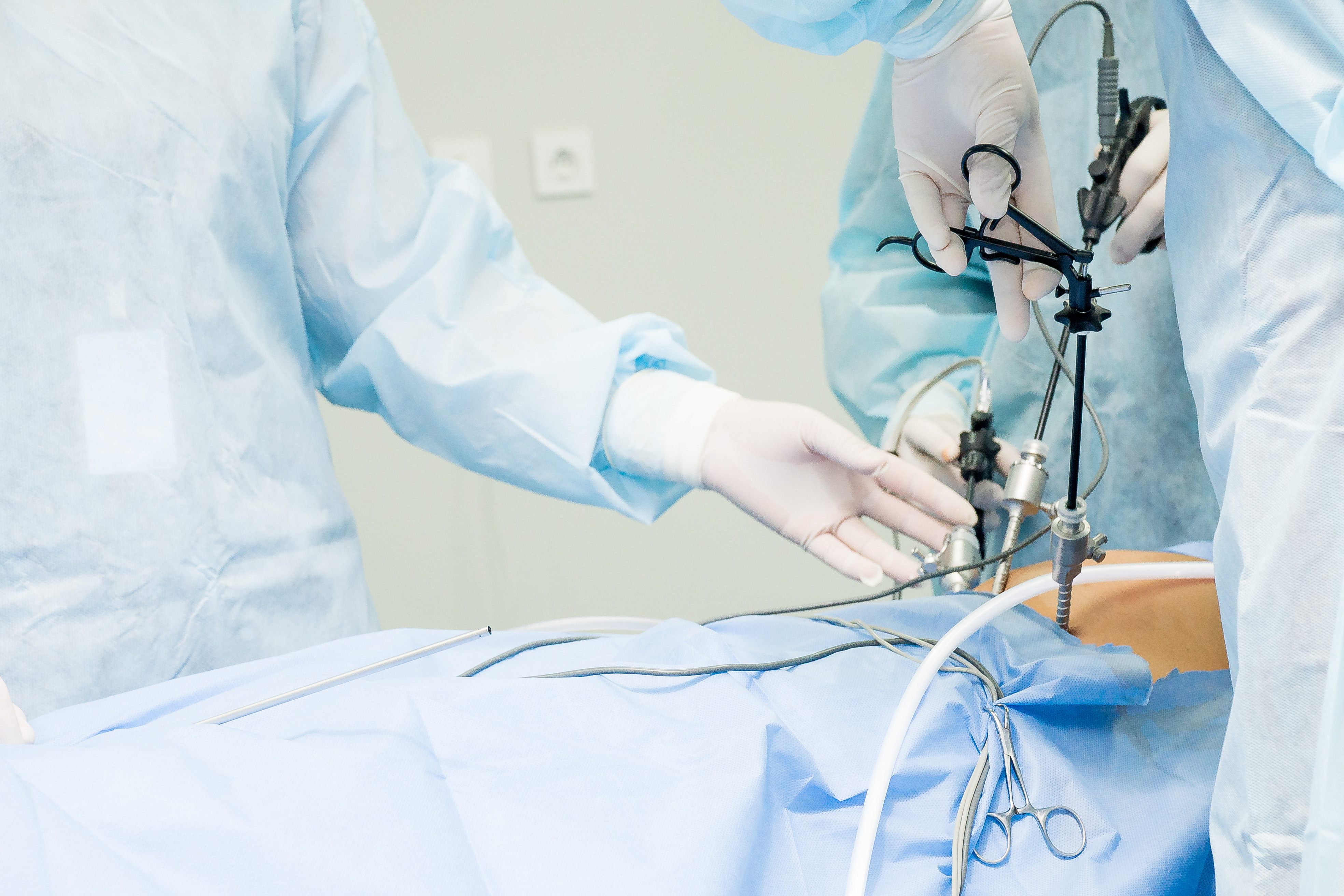 Лапароскопические операции в хирургии