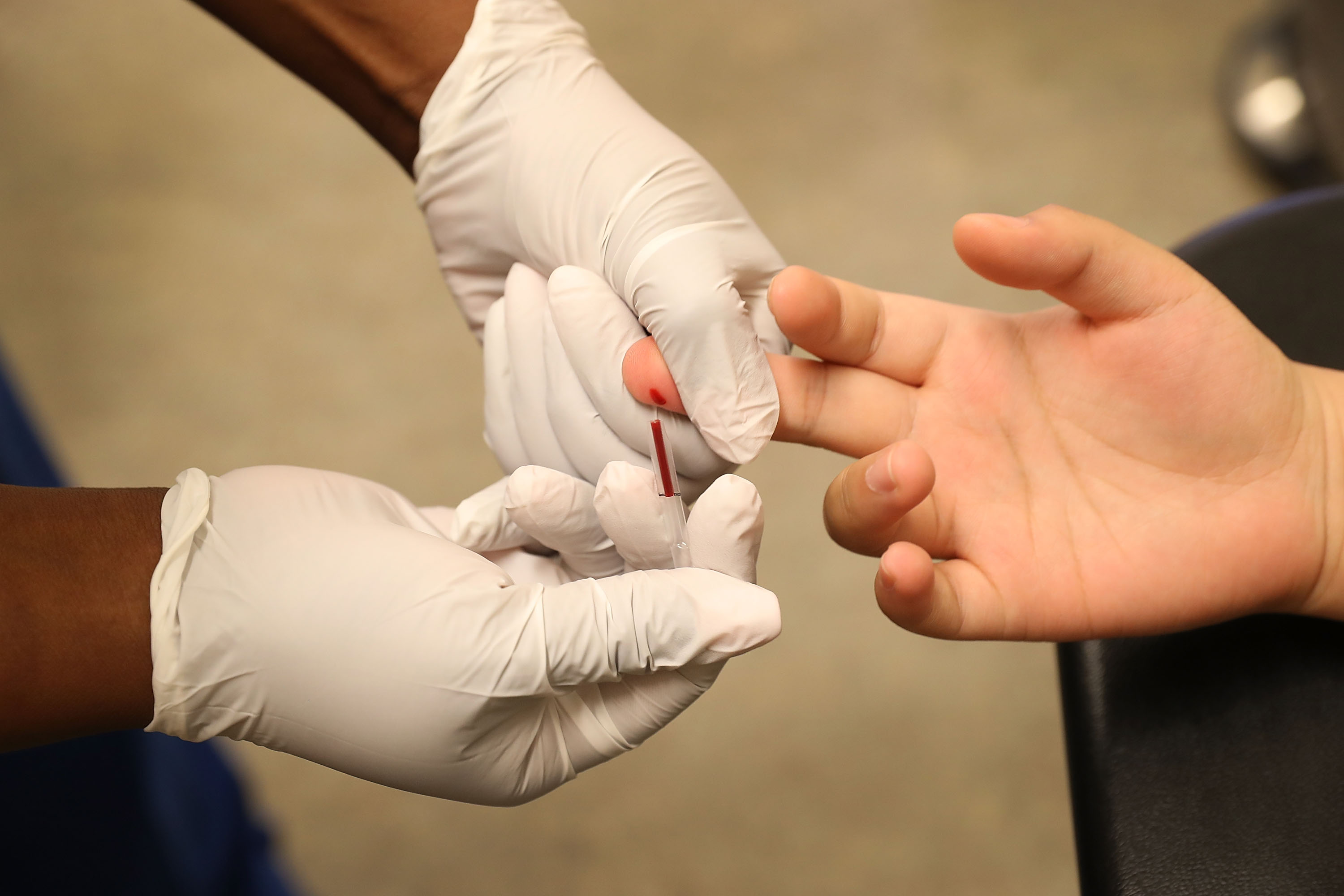 Анализ крови из пальца можно есть