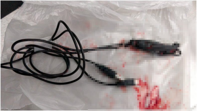Photo of USB cable post surgery.