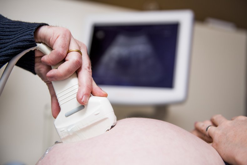 pregnancy ultrasound