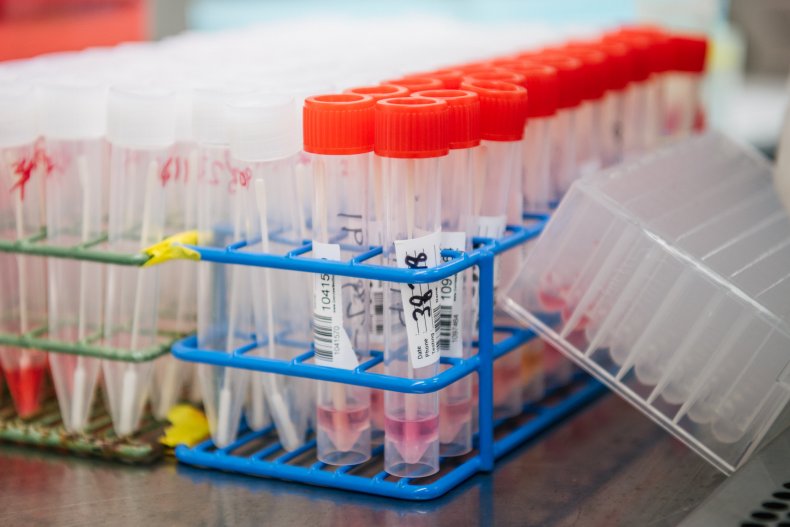 COVID sample vials