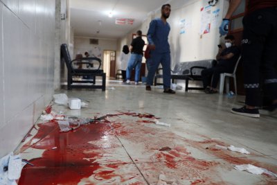 GRAPHIC Blood from shelling victims in Syria
