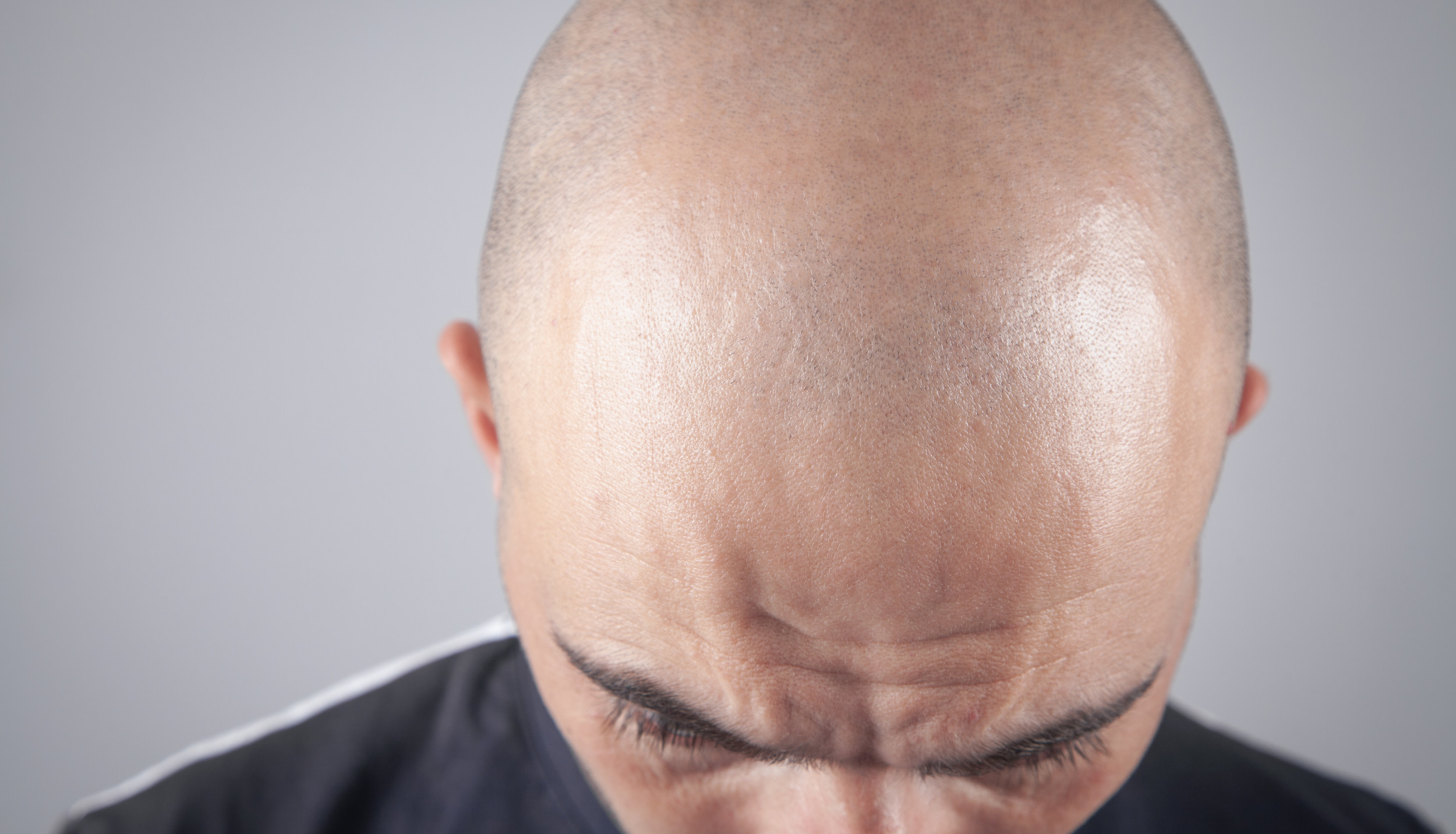 caucasian white male man in his mid thirties bald balding with short  cropped hair looking serious wearing a black top Stock Photo - Alamy