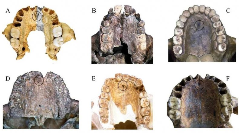 Ancient teeth