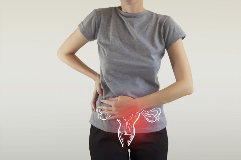 Uterus diagram