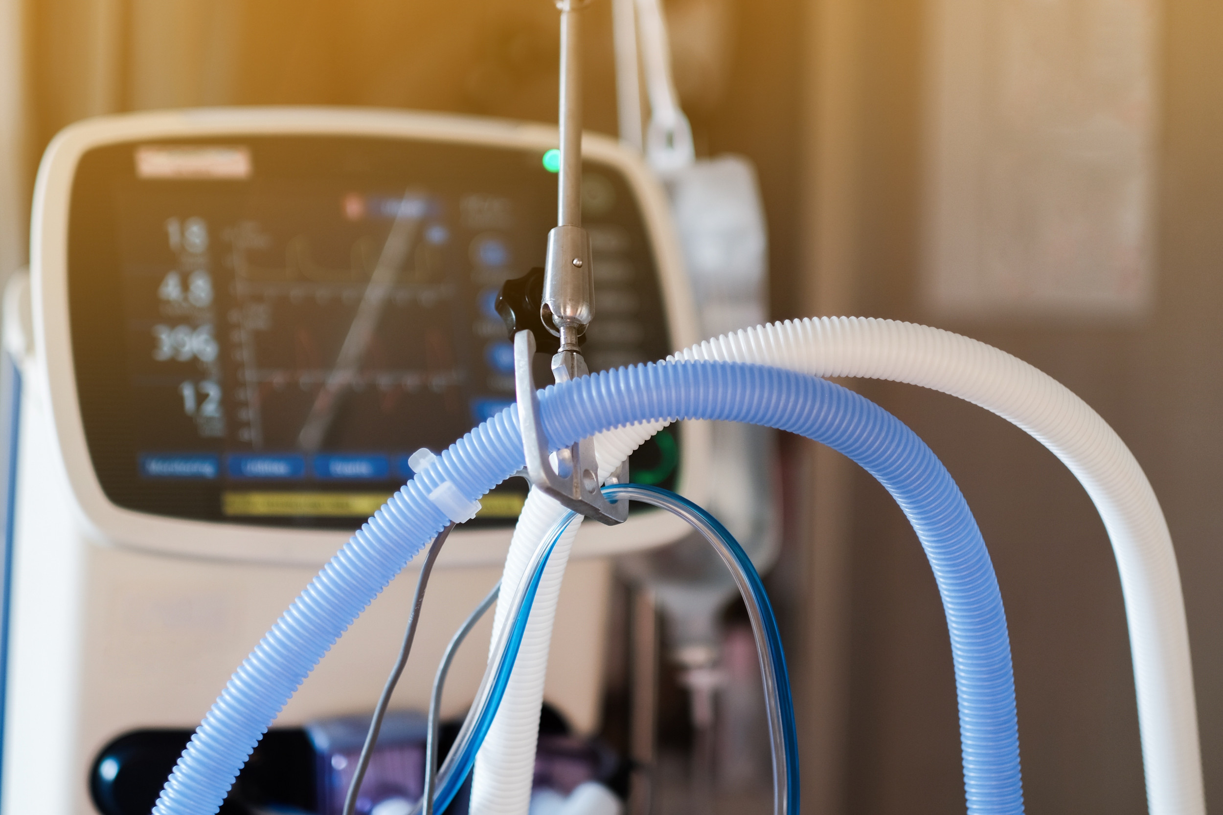 Viral Reddit Post Claims 60-Day COVID Intubation Cost Over $3M, Sparks Debate