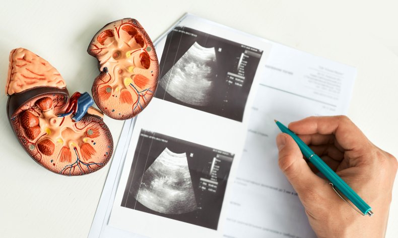 File photo of kidney doctor.